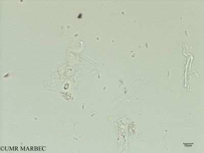 phyto/Scattered_Islands/iles_glorieuses/SIREME May 2016/Oxytoxum semicollatum (SIREME-Glorieuses2016-GLO5surf-121016-oxytoxum2)(copy)_thumb.jpg